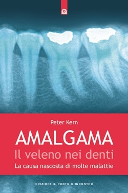 Amalgama: il veleno nei denti